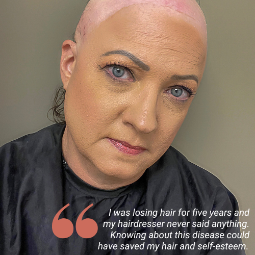 NSAAM 22 – SAF – Scarring Alopecia Foundation